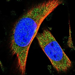 C15orf39 Antibody, Novus Biologicals 0.1mL; Unlabeled:Antibodies, Polyclonal